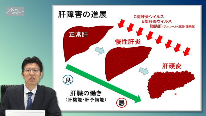 肝臓の解剖・疾患・治療の知識　【スライド資料ダウンロード】